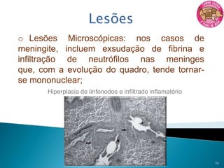 Sorotipos conhecidos: 2, 1, 1/2, 3, 4, 8, 9 e 7, 