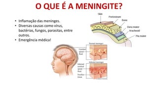 O QUE É A MENINGITE?
• Inflamação das meninges.
• Diversas causas como vírus,
bactérias, fungos, parasitas, entre
outros.
• Emergência médica!
 