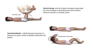 Sinal de Kernig- sinal de irritação meningea caraterizado
por uma limitação na extensão passiva dos membros
inferiores quando e m posição supina.
Sinal de Brudzinski- a flexão abrupta do pescoço no
paciente em supino resulta na fleaxão involuntária dos
joelhos.
 