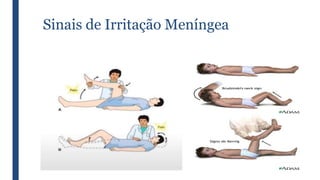 Sinais de Irritação Meníngea
 