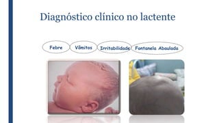 Diagnóstico clínico no lactente
Febre Vômitos Irritabilidade Fontanela Abaulada
 