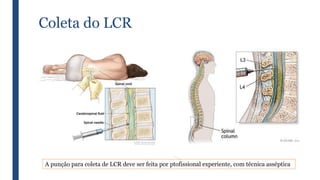 Coleta do LCR
A punção para coleta de LCR deve ser feita por ptofissional experiente, com técnica asséptica
 