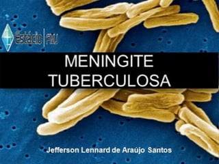 Meningite Tuberculosa 
Jefferson Lennard de Araújo Santos 
 