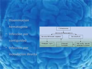 DiseminacionhematogenaInfeccion por contiguidadInfeccion por inoculacion directa