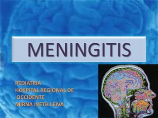 MENINGITIS PEDIATRIA HOSPITAL REGIONAL DE OCCIDENTE MIRNA IVETH LEIVA 