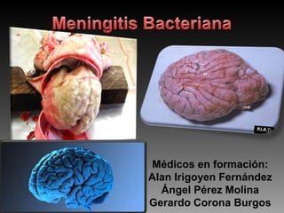 Meningitis Bacteriana Médicos en formación: Alan Irigoyen Fernández Ángel Pérez Molina Gerardo Corona Burgos 