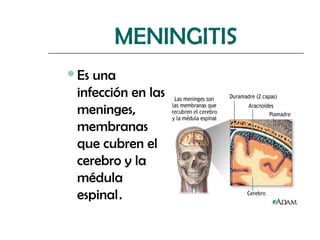MENINGITIS
Es una
 infección en las
 meninges,
 membranas
 que cubren el
 cerebro y la
 médula
 espinal.
 