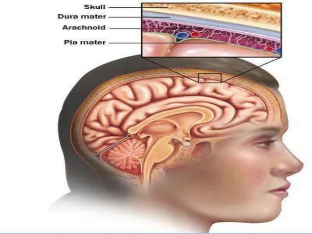 Meningitis Meningitis
