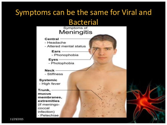 Meningitis 130905145512-