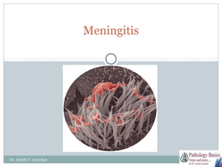 Meningitis

Dr. Ashish V. Jawarkar

 