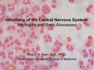 Infections of the Central Nervous System: 
Meningitis and Brain Abscesses 
Robyn S. Klein, M.D., Ph.D. 
Washington University School of Medicine 
 
