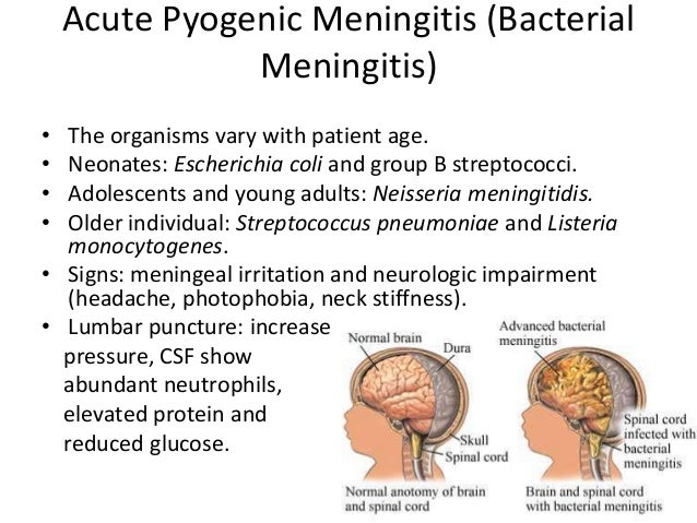 Viral meningitis symptoms in adults, girlfriend orgasms free fuckingsexys