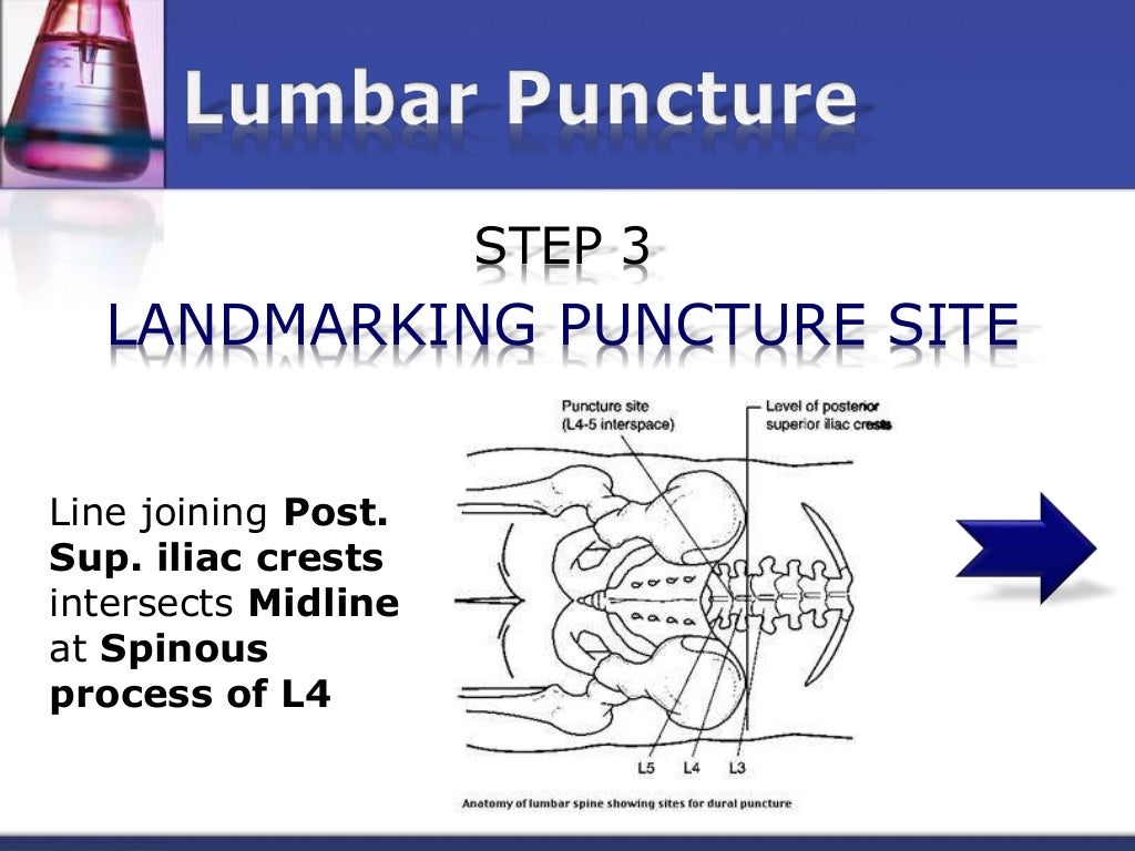 Lab diagnosis of Meningitis
