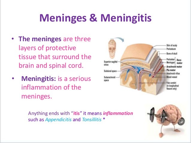 Meningitis