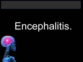 Encephalitis.
 