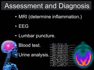 Assessment and Diagnosis
• MRI (determine inflammation.)
• EEG
• Lumbar puncture.
• Blood test.
• Urine analysis.
 