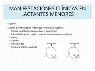 MANIFESTACIONES CLÍNICAS EN
LACTANTES MENORES
• Fiebre*
• Signos de inflamación meníngea mínimos o ausentes
• Rigidez nucal (ausencia no excluye el diagnóstico)
• Irritabilidad (rigidez nucal vs movimientos voluntarios de defensa)
• Letargo
• Anorexia
• Intranquilidad
• Fontanela anterior abultada
 