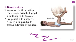 27
Kernig’s sign :
 is assessed with the patient
lying supine, with the hip and
knee flexed to 90 degrees.
 In a patient with a positive
Kernig's sign, pain limits
passive extension of the knee
 