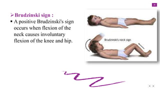 28
Brudzinski sign :
 A positive Brudzinski's sign
occurs when flexion of the
neck causes involuntary
flexion of the knee and hip.
 