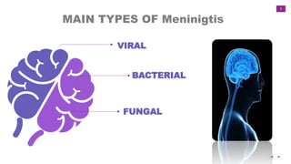 9
MAIN TYPES OF Meninigtis
VIRAL
FUNGAL
BACTERIAL
 