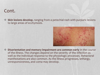 N Meningitis Rash Meningitis | PPTX