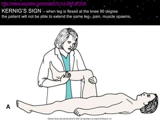 MENINGITIS | PPTX