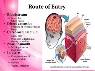 Route of Entry
• Bloodstream
– Insect bite
– Otitis media
• Direct extension
– Fracture of frontal or facial
bones
• Cerebrospinal fluid
– Dural tear
– Poor sterile technique
during procedure
• Nose or mouth
– Meningococcus
meningitis
• In utero
– Contamination of
amniotic fluid
– Rubella
– Vaginal infection
 