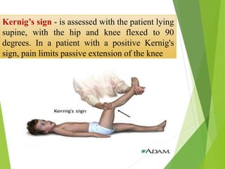 Meningitis in children | PPTX