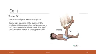 09/03/2024 MENINGITIS 34
Cont…
Kernig’s sign
Vladimir Kernig was a Russian physician
Kernig sign is present if the patient, in the
supine position with the hip and knee flexed at
90º, cannot extend the knee more than 135º
and/or there is flexion of the opposite knee.
 