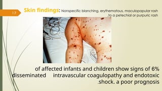 Non Specific Rash MENINGITIS causes and nurses management.pptx