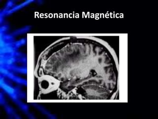 Resonancia Magnética
 