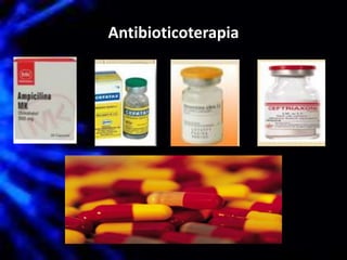 Antibioticoterapia
 