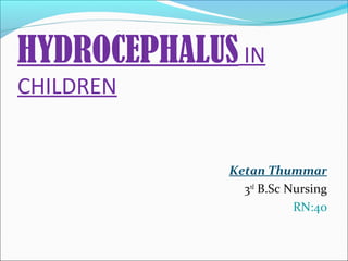 HYDROCEPHALUS IN
CHILDREN

Ketan Thummar
3rd B.Sc Nursing
RN:40

 