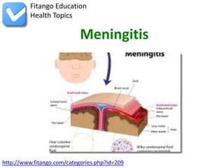 Fitango Education
          Health Topics

                            Meningitis




http://www.fitango.com/categories.php?id=209
 