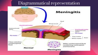 Diagrammatical representation
 