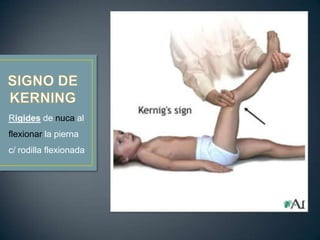 Rigides de nuca al
flexionar la pierna

c/ rodilla flexionada

 