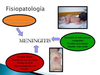 Diseminación hematógena
sepsis, infecciones respiratorias

Extensión de infección por
contiguidad
(Celulitis periorbitaria
sinusitis, otitis media

Entrada directa
Fractura de base de cráneo
Fístulas de LCR
Mielomeningocele roto
Cirugías

 