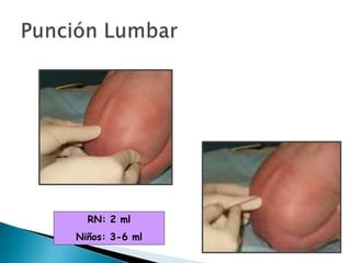 RN: 2 ml
Niños: 3-6 ml

 