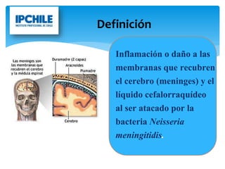 Definición
Inflamación o daño a las
membranas que recubren
el cerebro (meninges) y el
líquido cefalorraquídeo
al ser atacado por la
bacteria Neisseria
meningitidis.
 