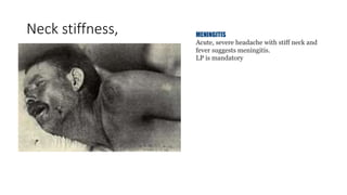 Neck stiffness, MENINGITIS
Acute, severe headache with stiff neck and
fever suggests meningitis.
LP is mandatory
 