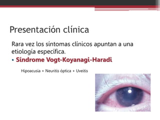 Presentación clínica
Rara vez los síntomas clínicos apuntan a una
etiología específica.
• Síndrome Vogt-Koyanagi-Haradi
Hipoacusia + Neuritis óptica + Uveitis
 