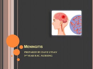 MENINGITIS
PREPARED BY DAVE UTSAV
3rd YEAR B.SC. NURSING
 