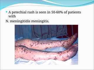 N Meningitis Rash Comprehensive Overview of Meningitis: Bacterial, Tuberculous ...