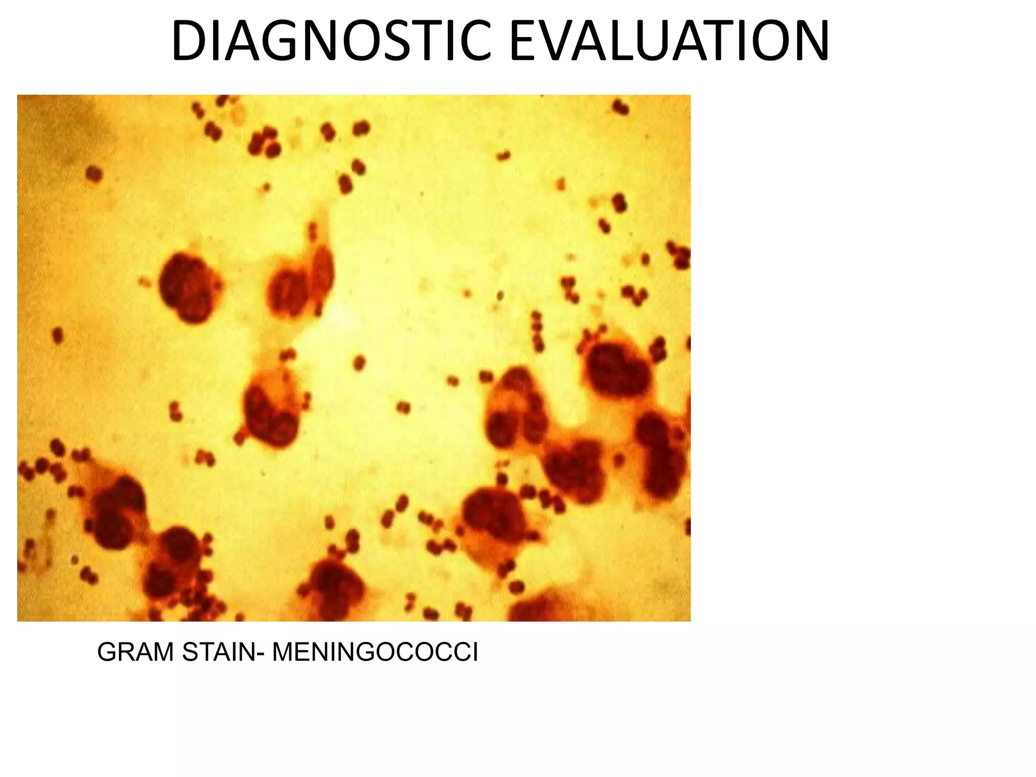 DIAGNOSTIC EVALUATION
7 March 2023 MENINGITIS 26
GRAM STAIN- MENINGOCOCCI
 