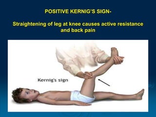 MENINGITIS IN CHILDREN PPT meningitis-in-children-ppt