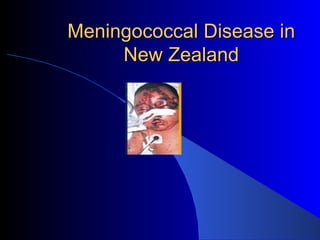 Meningococcal Disease in New Zealand 