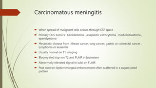 MENINGITIS NEUROIMAGING KRITIKA sms neurology ptx | PPTX