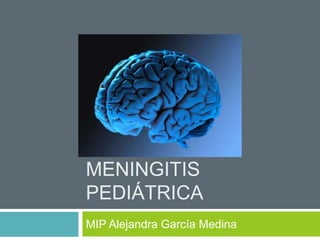 MENINGITIS
PEDIÁTRICA
MIP Alejandra García Medina
 