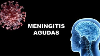 MENINGITIS
AGUDAS
 