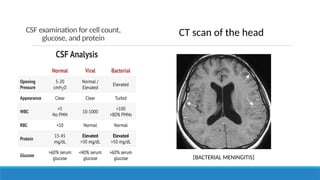 CSF examination for cell count,
glucose, and protein
CT scan of the head
[BACTERIAL MENINGITIS]
 